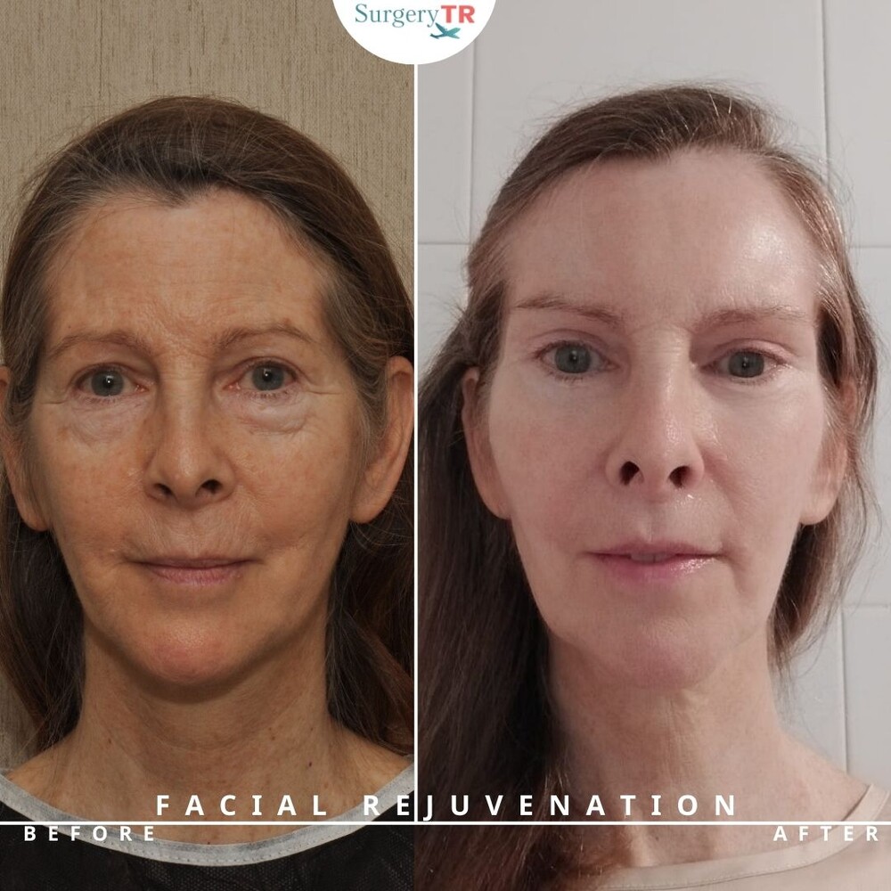 Clinic Results Gallery